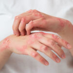 wn-tree-of-life-empire-hives-testimonial