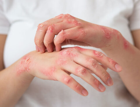 wn-tree-of-life-empire-hives-testimonial