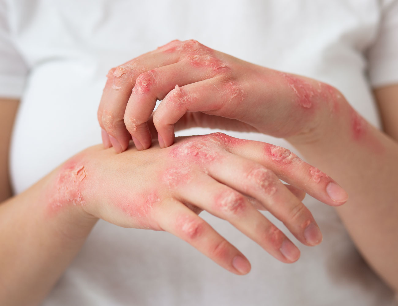 wn-tree-of-life-empire-hives-testimonial
